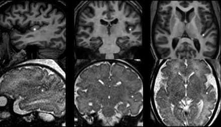 FIG 1.