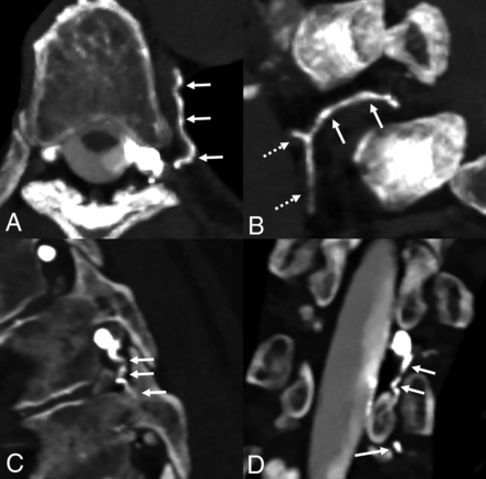 FIG 1.
