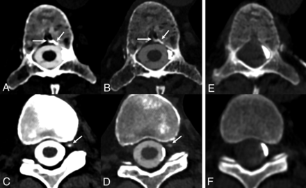 FIG 2.