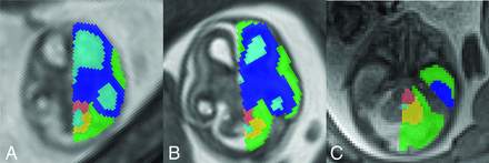 FIG 1.
