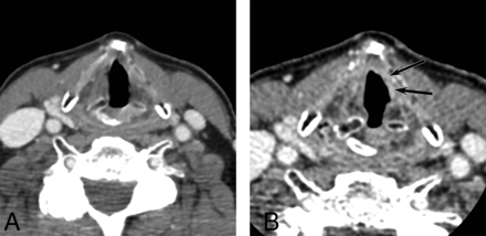 FIG 1.