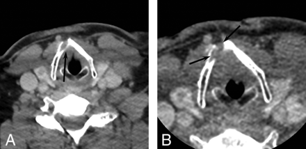 FIG 2.