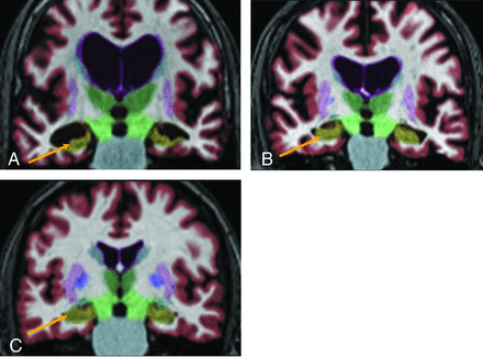 FIG 2.