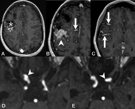 Fig 2.