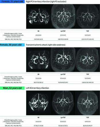 FIG 3.