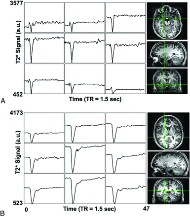 FIG 1.