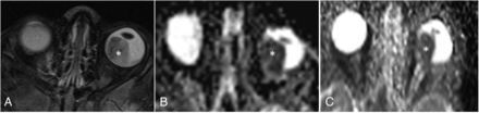 FIG 3.