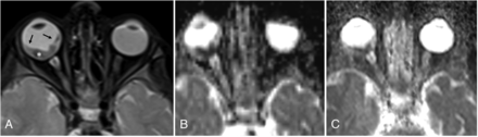 FIG 5.