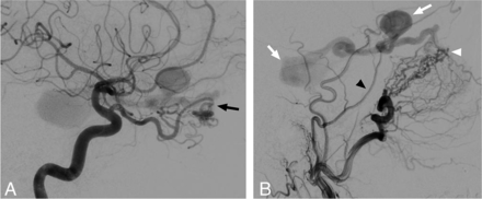 FIG 3.