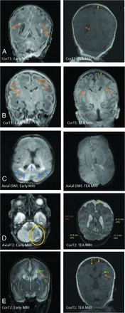 FIG 1.