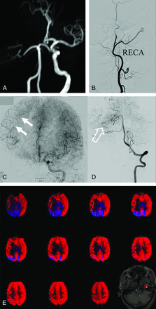 FIG 3.