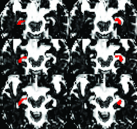 FIG 2.