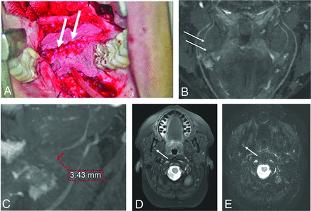 FIG 3.