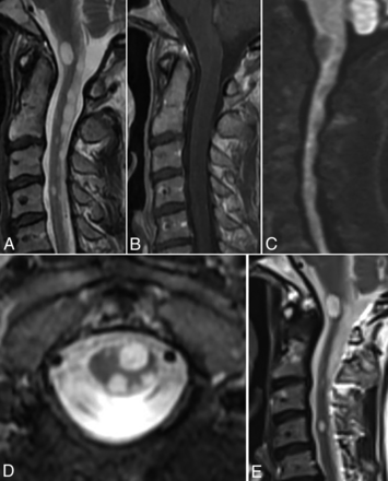 FIG 2.