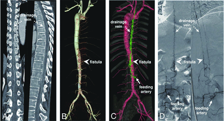 FIG 4.