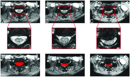 FIG 2.
