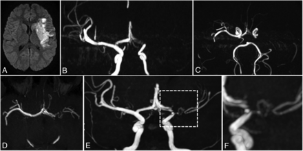 FIG 2.