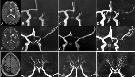 FIG 3.