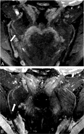 FIG 2.