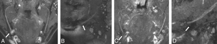 FIG 3.
