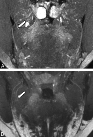FIG 4.