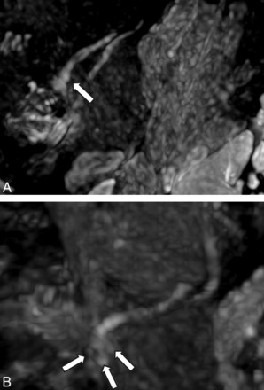 FIG 5.