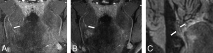 FIG 6.