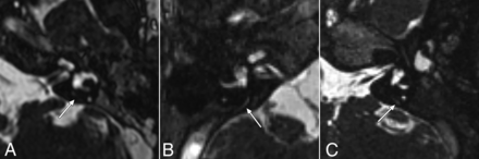 FIG 3.
