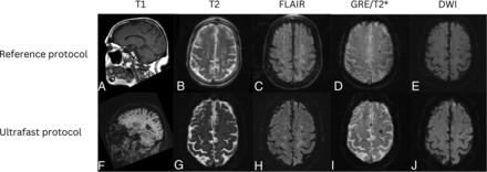 FIG 3.