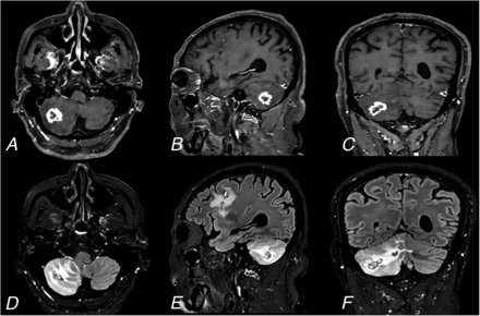 FIG 7.