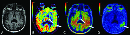 FIG 2.