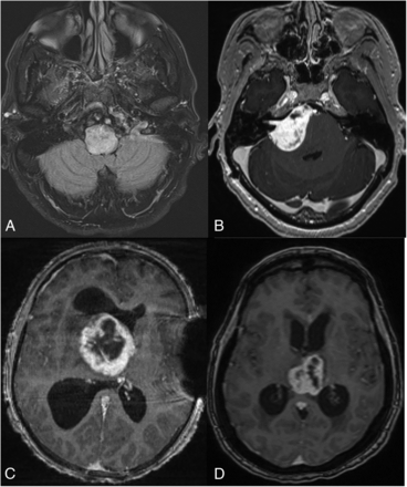 FIG 2.