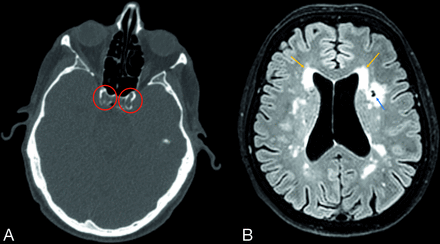 FIG 1.