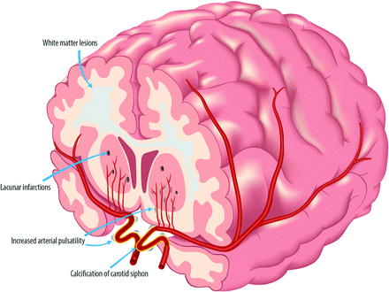 FIG 3.