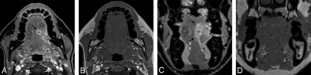 FIG 4.