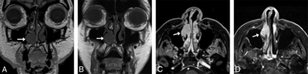 FIG 5.
