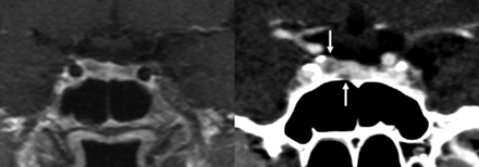 FIG 1.