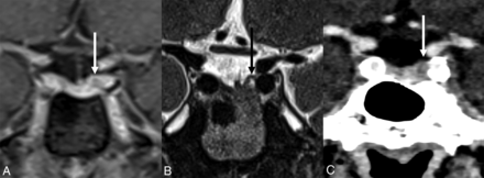 FIG 2.