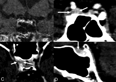 FIG 3.