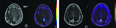 FIG 4.