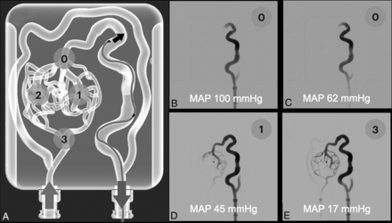 FIG 2.