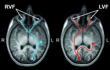 FIG 1.