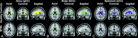 FIG 3.