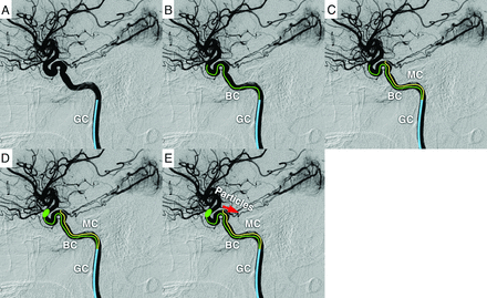 FIG 1.
