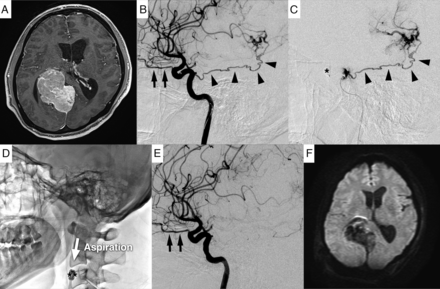 FIG 3.