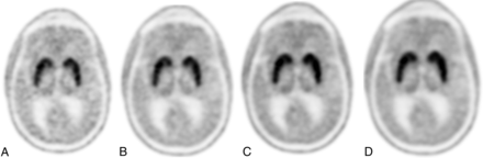 FIG 2.