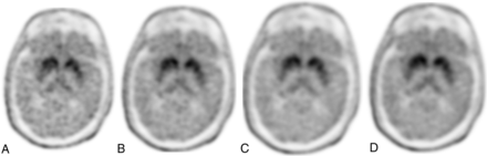 FIG 3.