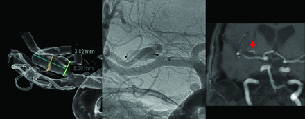 FIG 3.