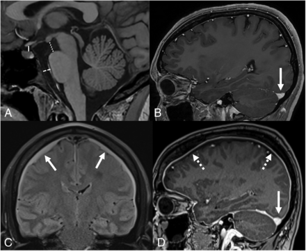 FIG 3.