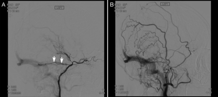 FIG 3.